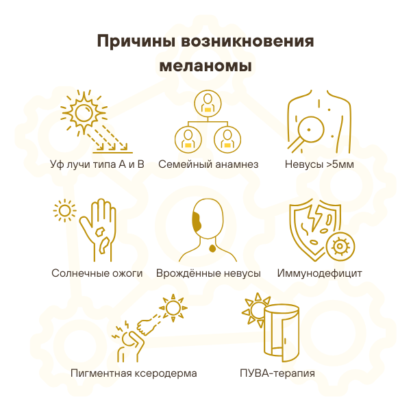 Причины возникновения меланомы